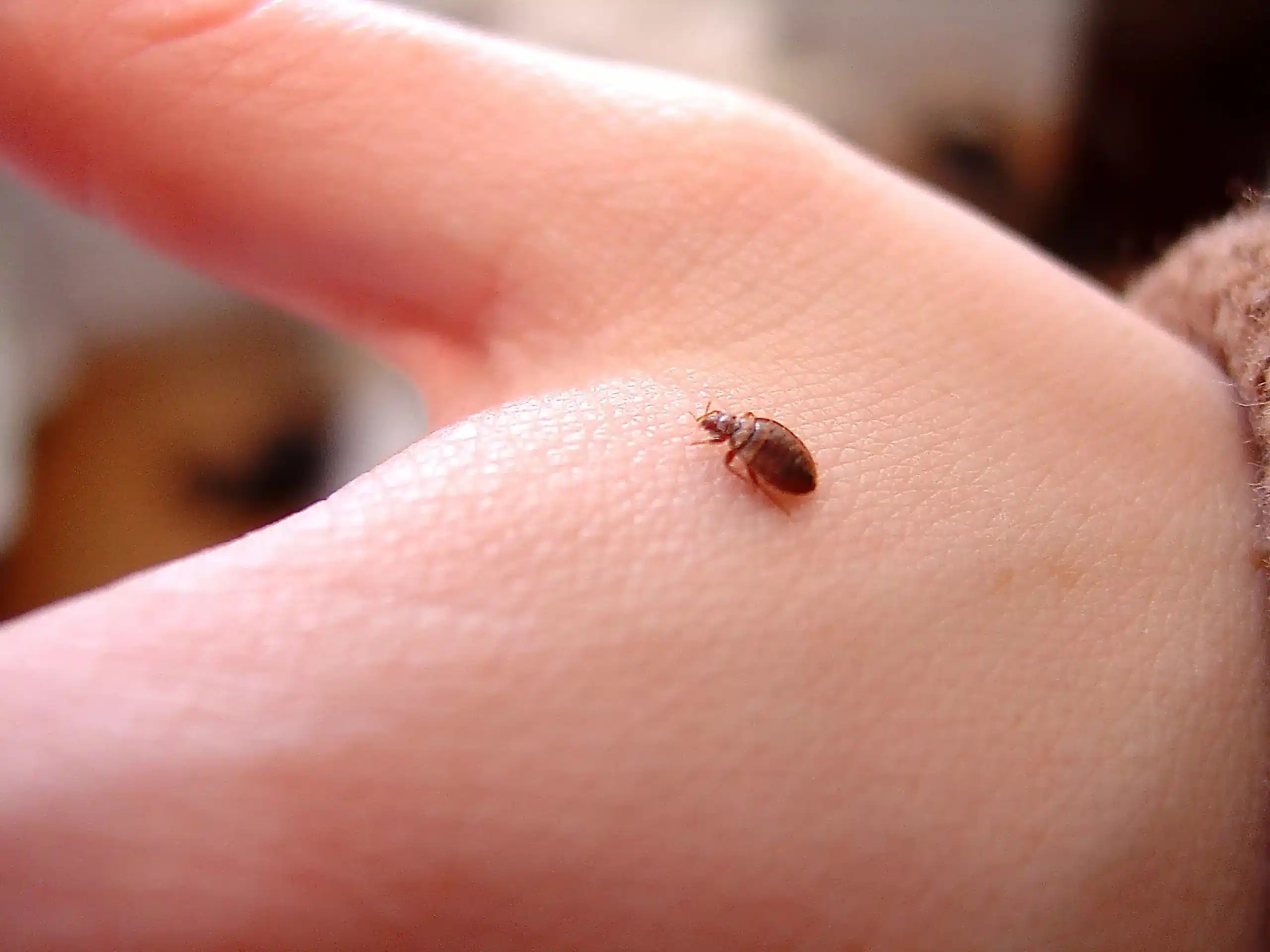 https://www.exterminationdenuisibles.be/wp-content/uploads/2022/10/bed-bug-on-hand_2592x1944-min-scaled.webp